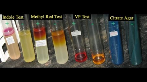 methyl red and voges-proskauer test|37: IMViC tests .